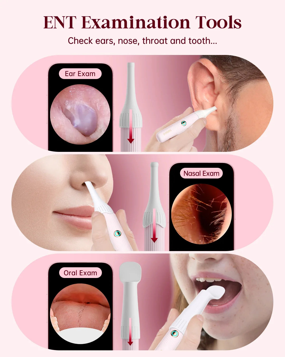 [Pink Color] Bebird EarSight Plus I35R Visual Earpick Ear Cleaner Bendable & Affordable All-in-1 Ear Rod Earwax Removal Kits
