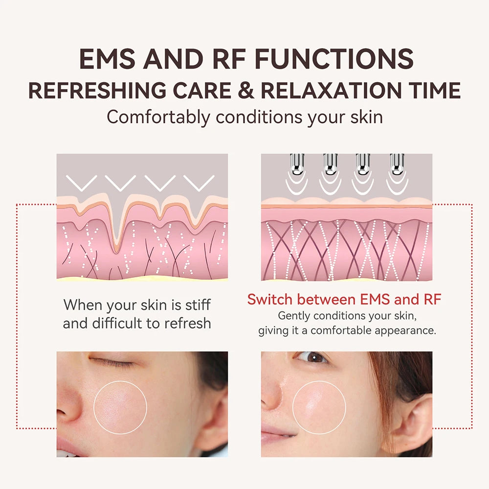 ANLAN RF Acupoint Massager Dual-head Dual-mode Design EMS Relieves Fatigue RF+EMS Skin Firming Face Skincare Beauty Device