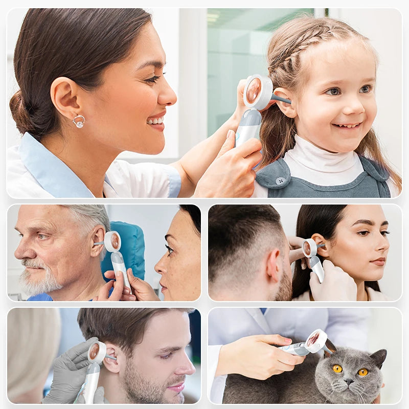1080P Visual Ear Camera Ear Mouth Check 2M Pixels Camera Ear Wax Cleaner Camera for Ears Nose Skin Support 90° Rotating Heads