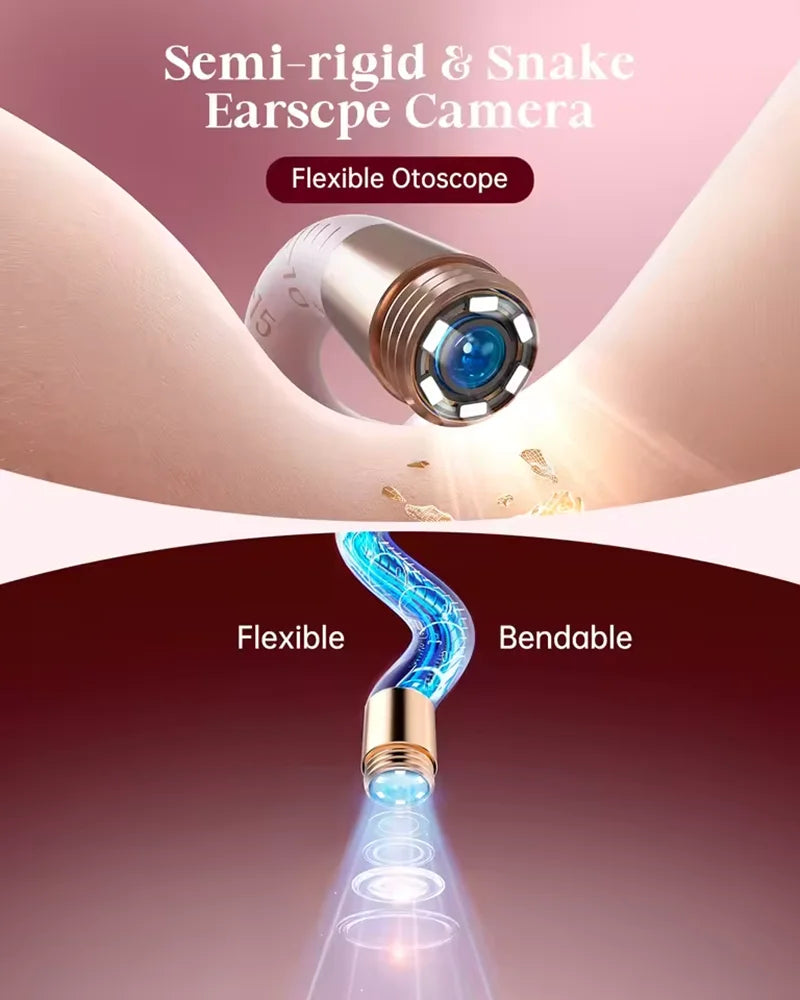[Pink Color] Bebird EarSight Plus I35R Visual Earpick Ear Cleaner Bendable & Affordable All-in-1 Ear Rod Earwax Removal Kits