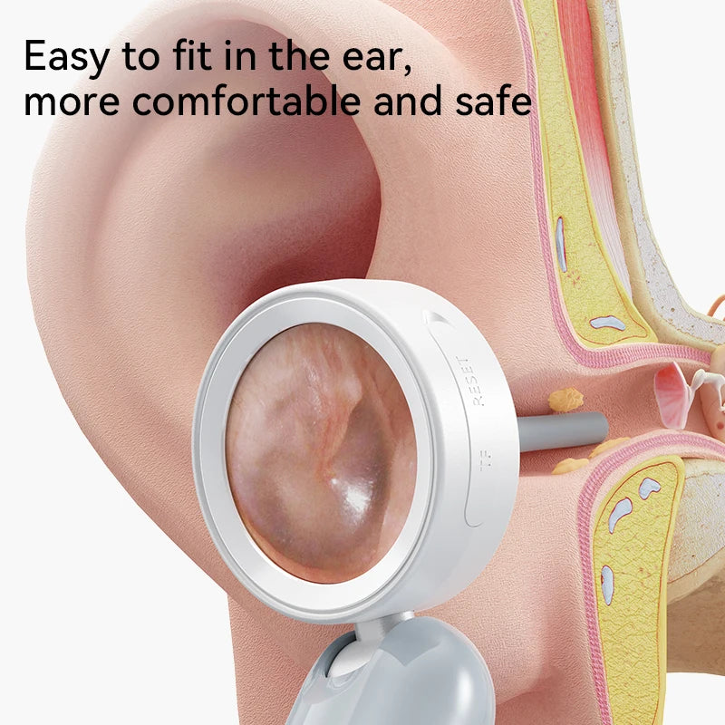 1080P Visual Ear Camera Ear Mouth Check 2M Pixels Camera Ear Wax Cleaner Camera for Ears Nose Skin Support 90° Rotating Heads