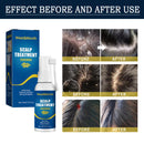Hair Care Hair Follicle Damage Hair Root Care Spray