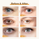 Hydrating, Moisturizing, Improving Eye Care, Eye Lifting And Brightening Essence, Eye Care Cream